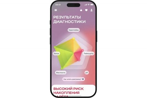 Phygital в стоматологии: SPLAT представила экспресс-диагностику на базе компьютерного зрения